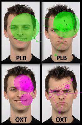 Nasal Oxytocin Treatment Biases Dogs’ Visual Attention and Emotional Response toward Positive Human Facial Expressions